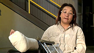 A women recovering from a broken leg